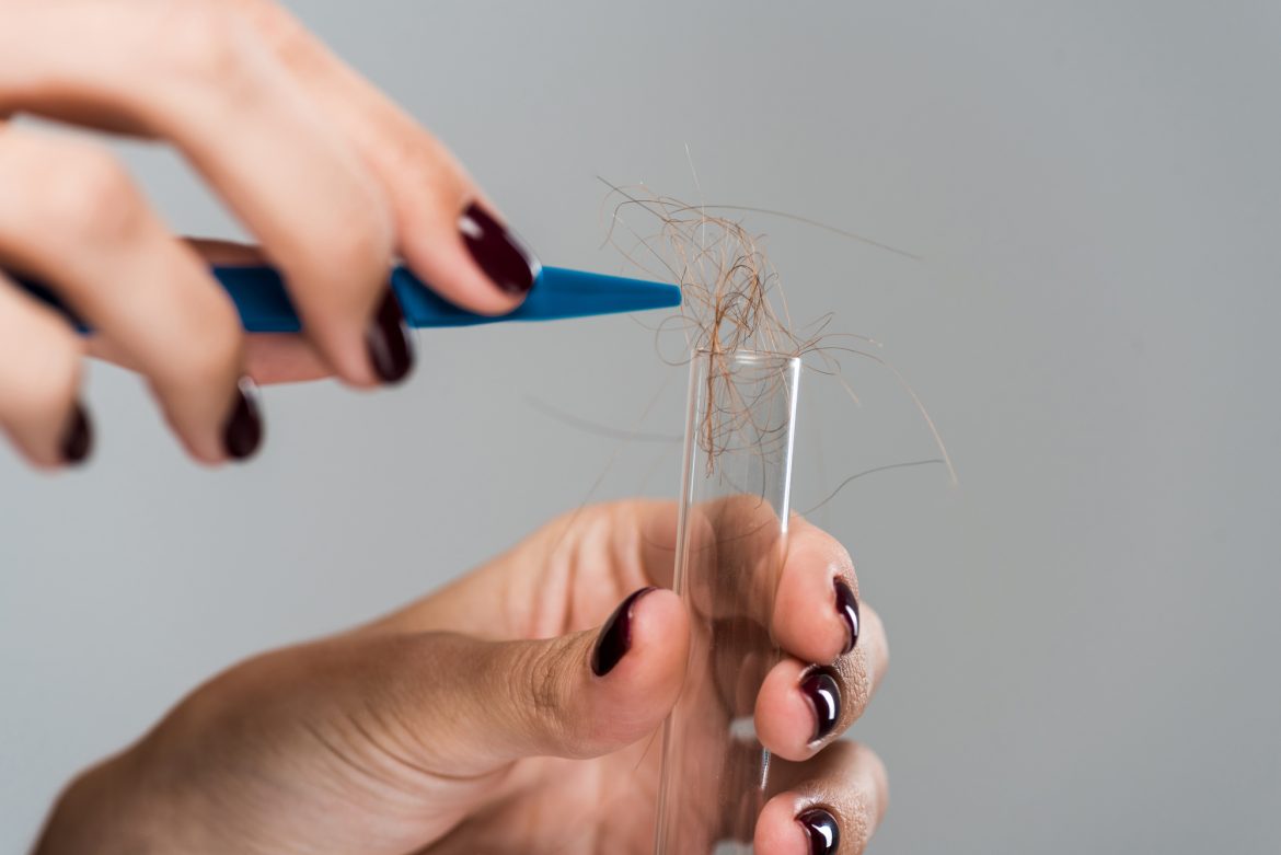 How Far Back Do Hair Follicle Drug Test? Clear The Drug Test