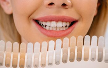 Veneers: The Silent Revolution in Dental Restoration Techniques